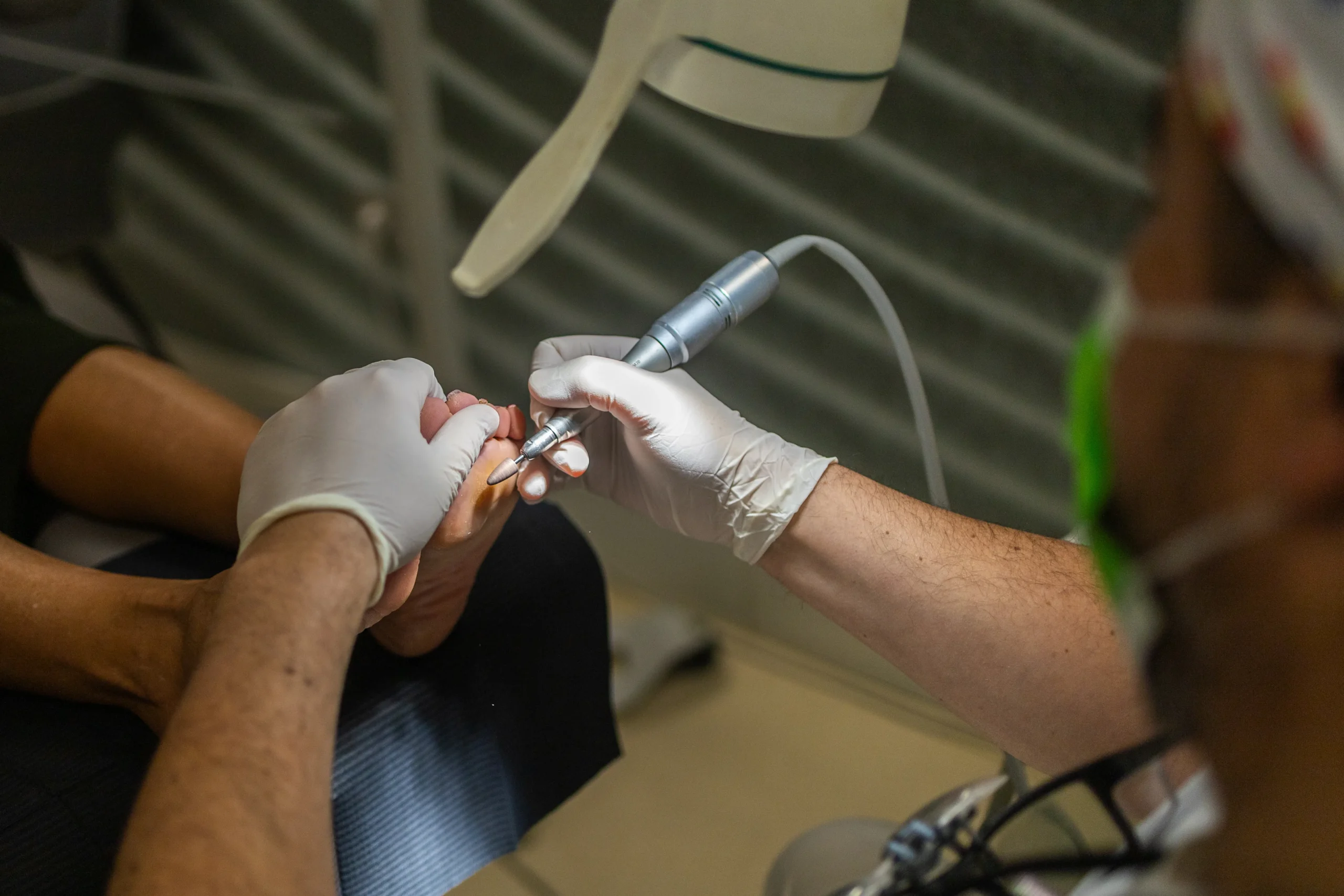 Ampollas en los pies, evítalas en Málaga