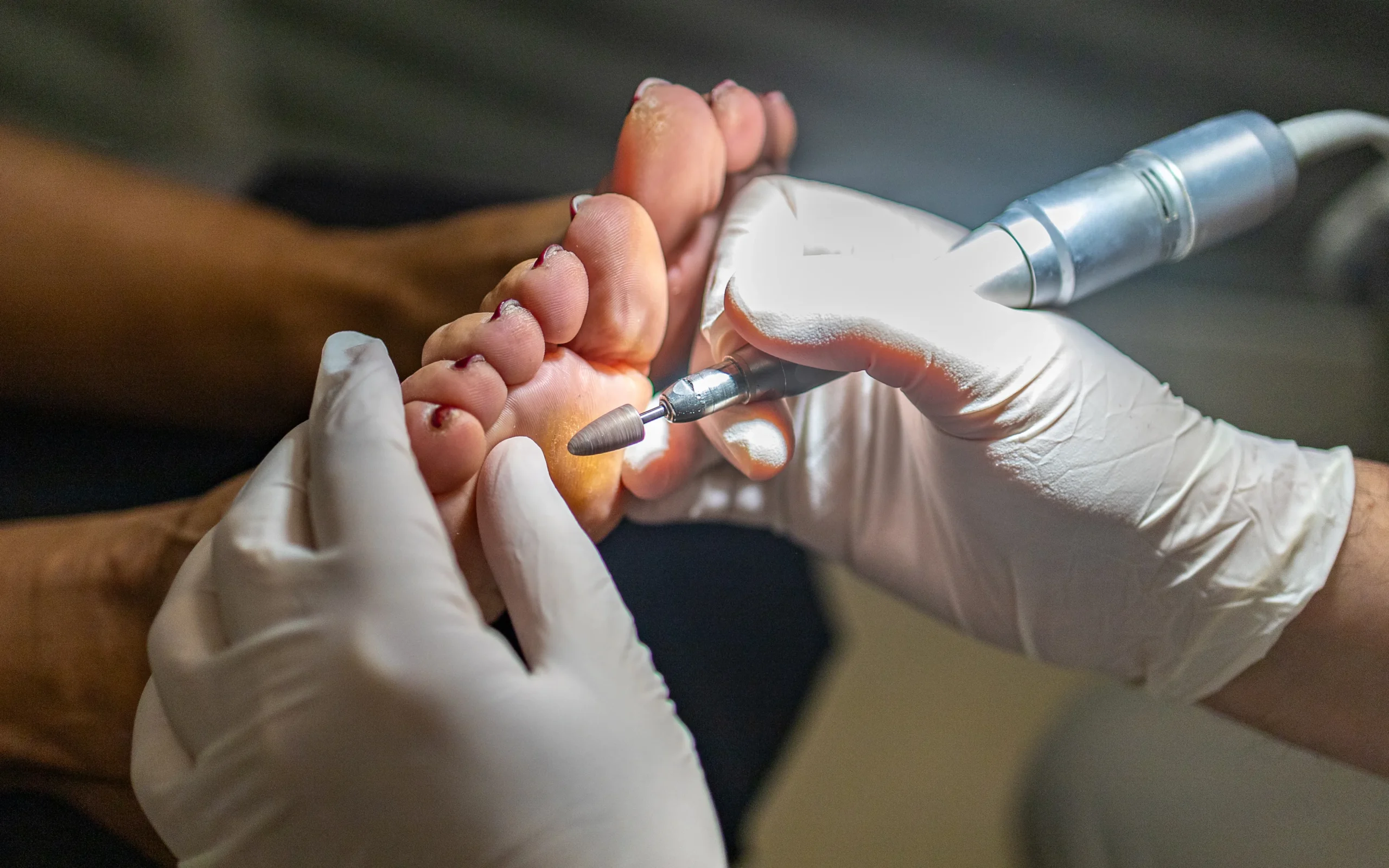 Geriatric Podiatry, Special Care for the Elderly 3 Geriatric podiatry, special care for the elderly