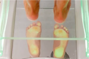 Callos y durezas, su tratamiento