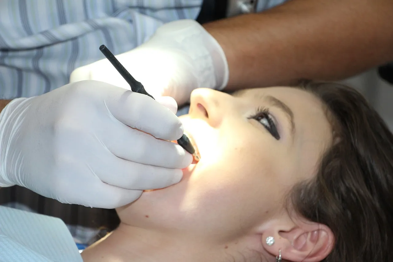 Implantes dentales Málaga todo lo que necesitas saber antes de colocarlos