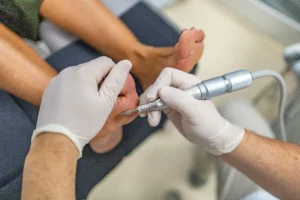 Callos y durezas, su tratamiento